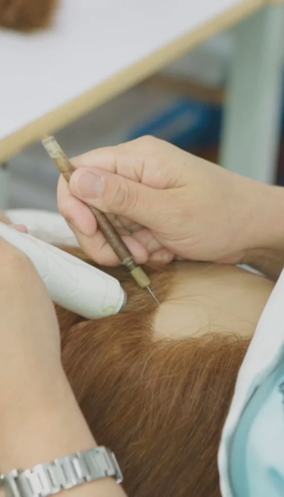 Pivot Point Mannequin Hair Implantation